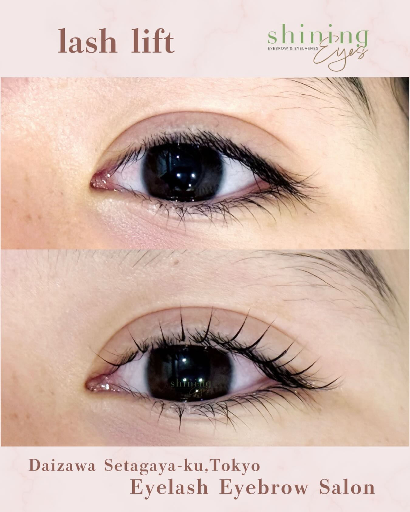 中高生の方でも安心して受けていただける