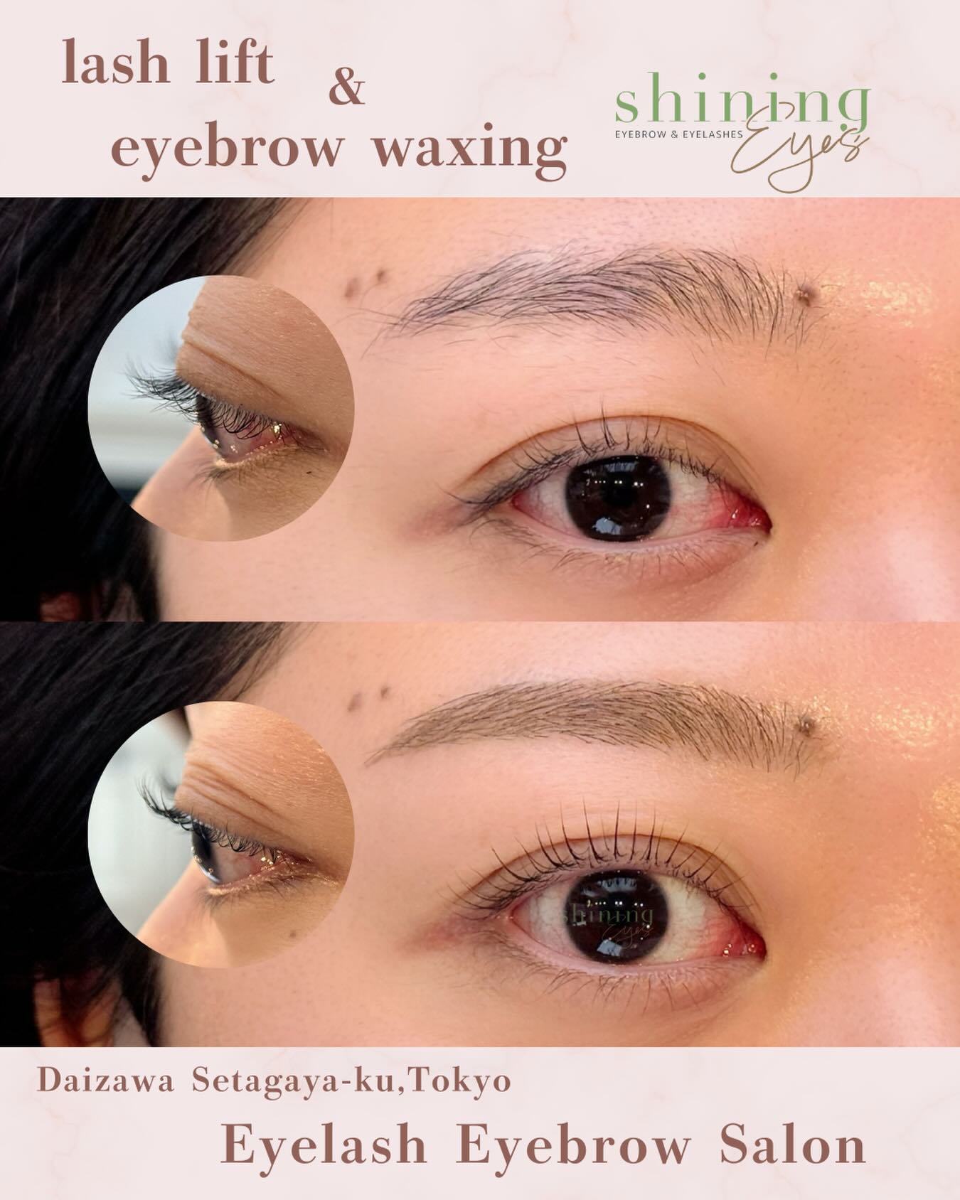 shiningeyesではまつ毛の長さ、生え方、瞼の形状、ご