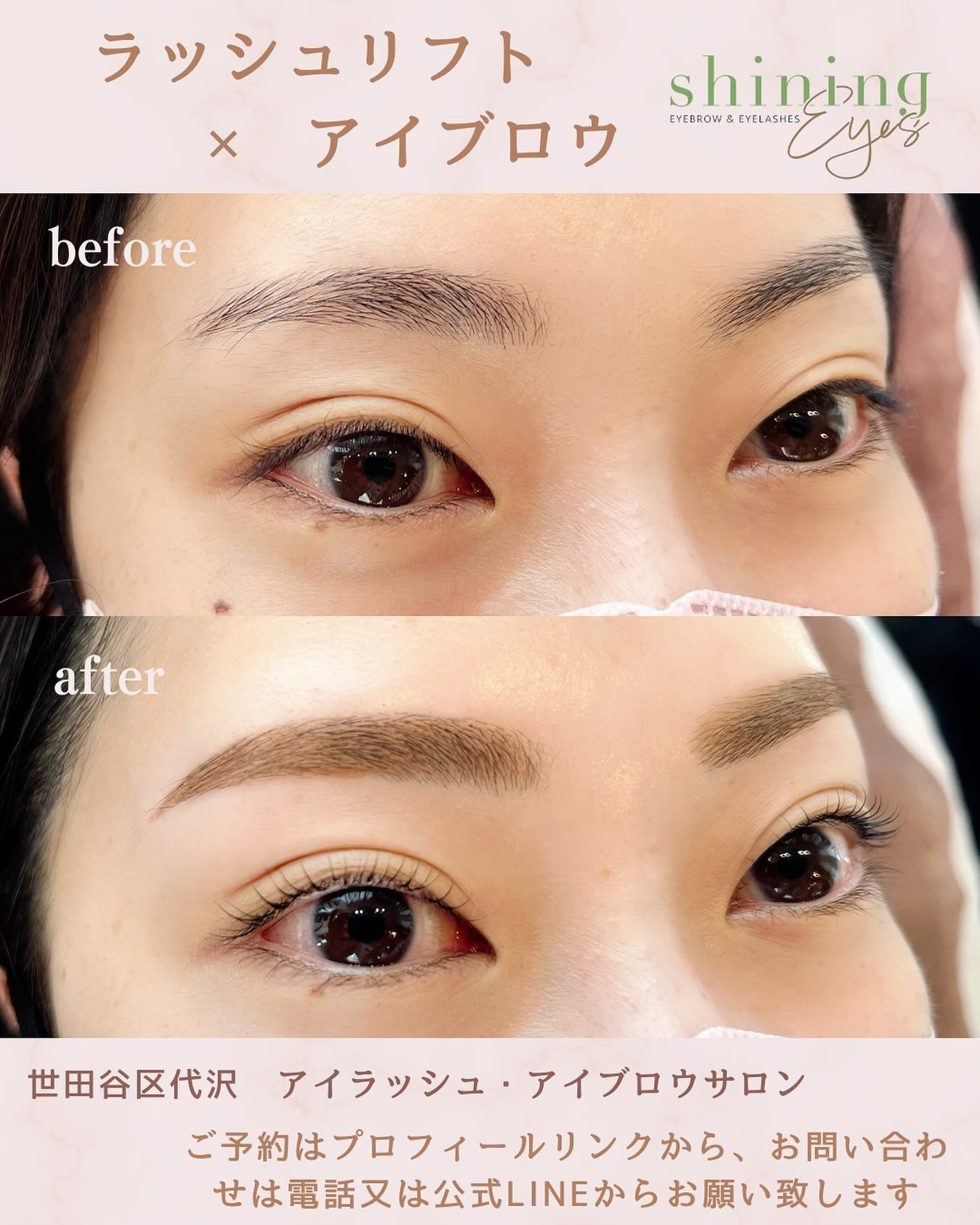 ラッシュリフトはまつ毛のカールを持続させるための技術であり、