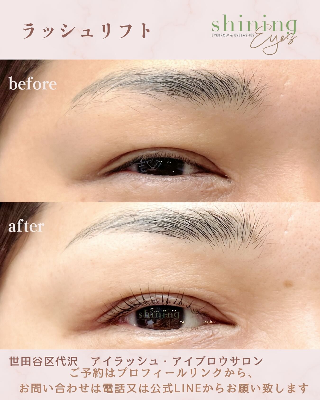 shining eyesは、お客様一人ひとりのまつ毛の長さや